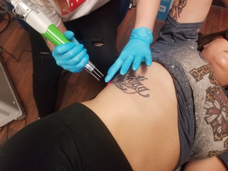 Tattoo Removal (0) in Fort Wayne IN