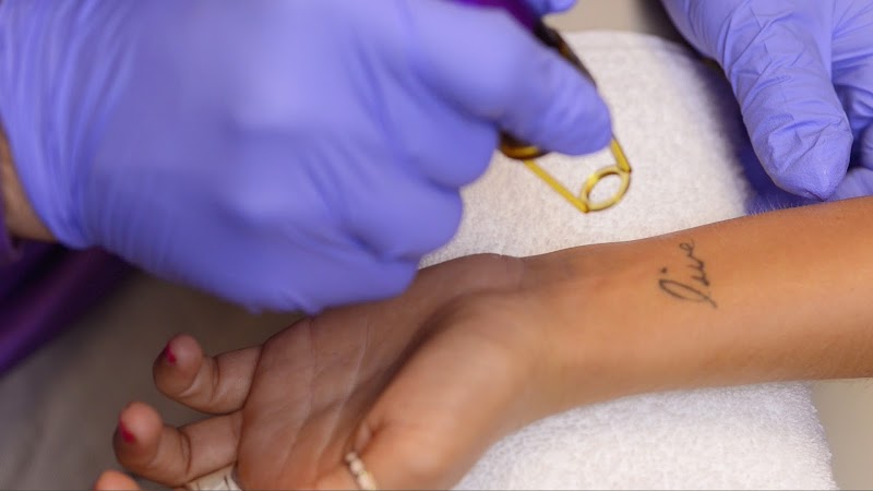 Tattoo Removal (0) in Irving TX