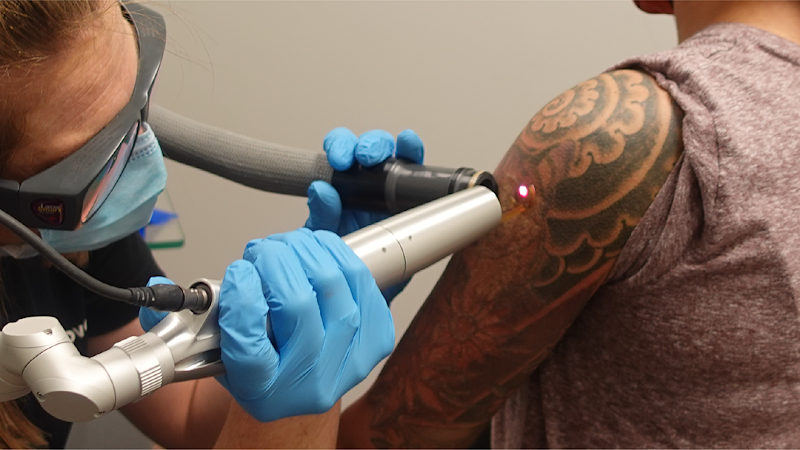 Tattoo Removal (0) in Plano TX