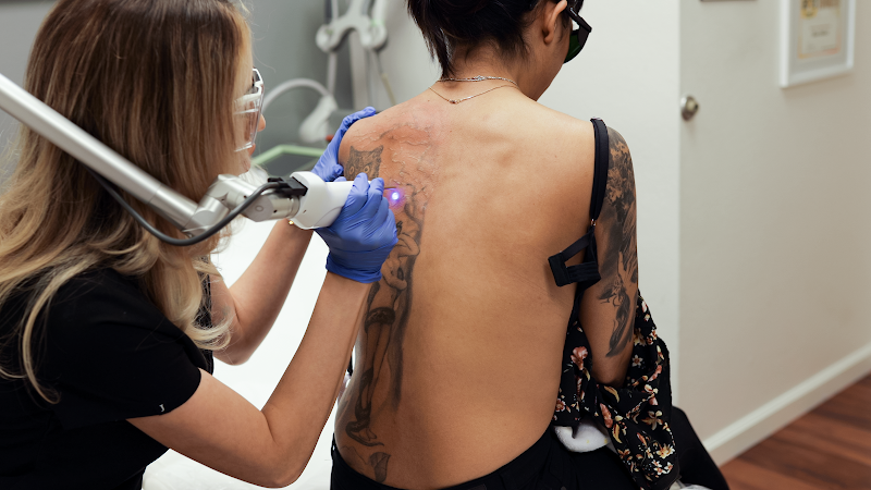 What Colors Of Ink Are The Best For Tattoo Removal  LaserAway