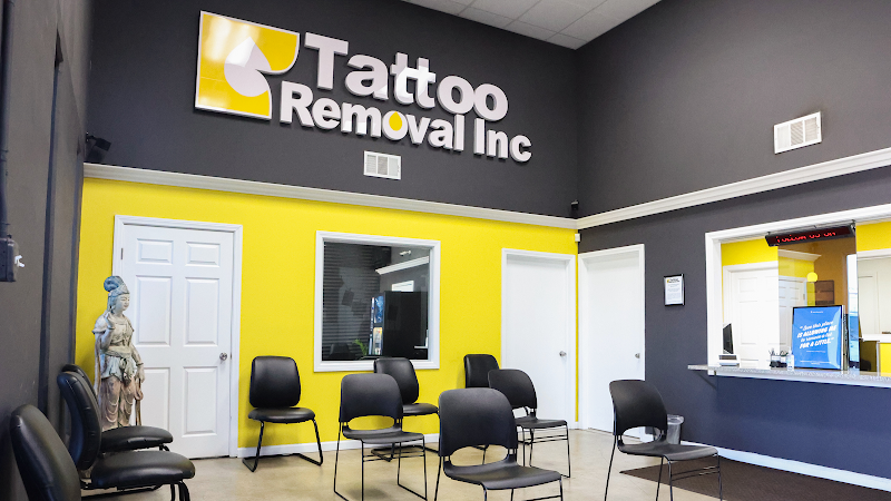 Tattoo Removal (2) in Long Beach CA