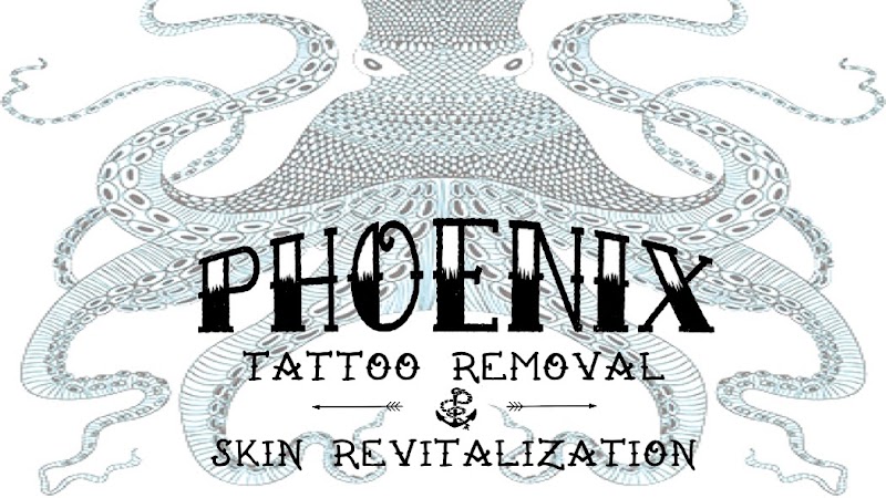 Tattoo Removal (3) in Phoenix AZ