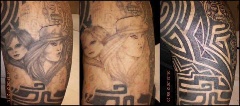Tattoo Removal (3) in Reno NV